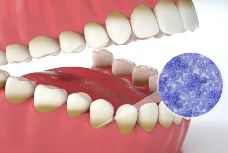 La chirurgie parodontale : une compétence enseignée au cours des études dentaires en Espagne